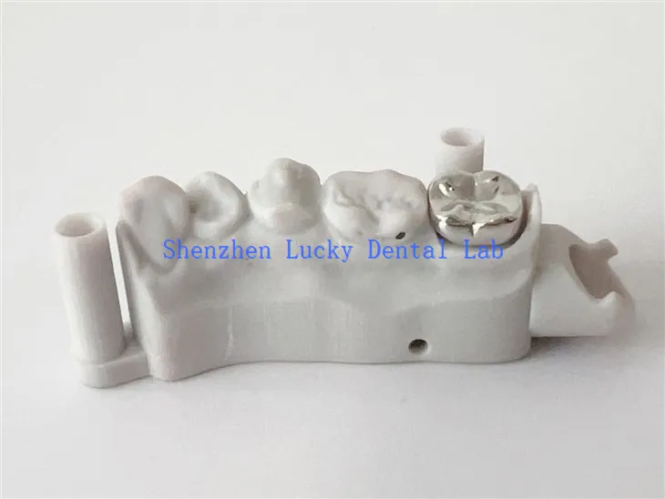 China High Quality 3D Print Dental Full Metal Crown
