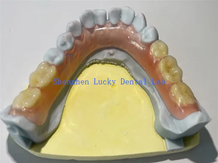 Bekväma partiella flexibla tandprotesstillverkare