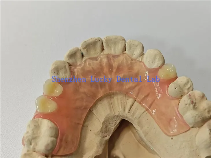 Bekväm flexibel tandproteslaboratorium