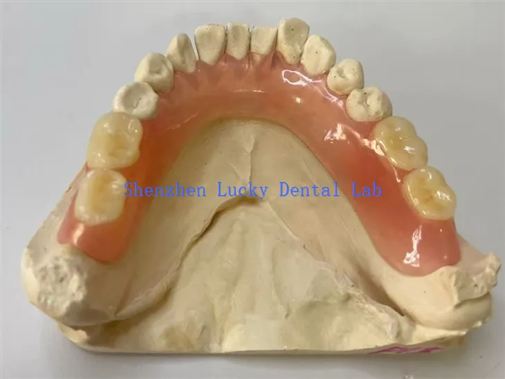 Partiell flexibel tandläkarlaboratorium