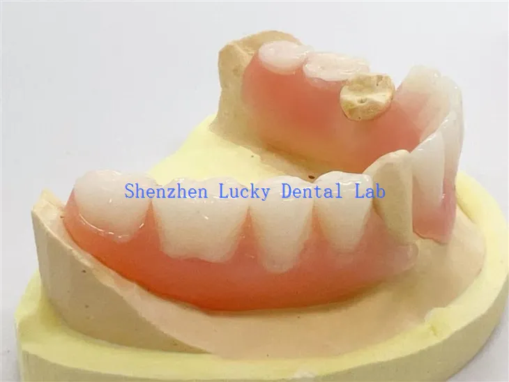 Högkvalitativ tandpartiflexibel tandprotes