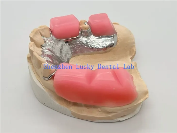 Metallram med bettblock