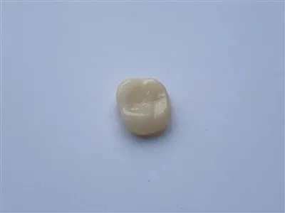 3D Print Metal Free Ceramic Zirconia Crown